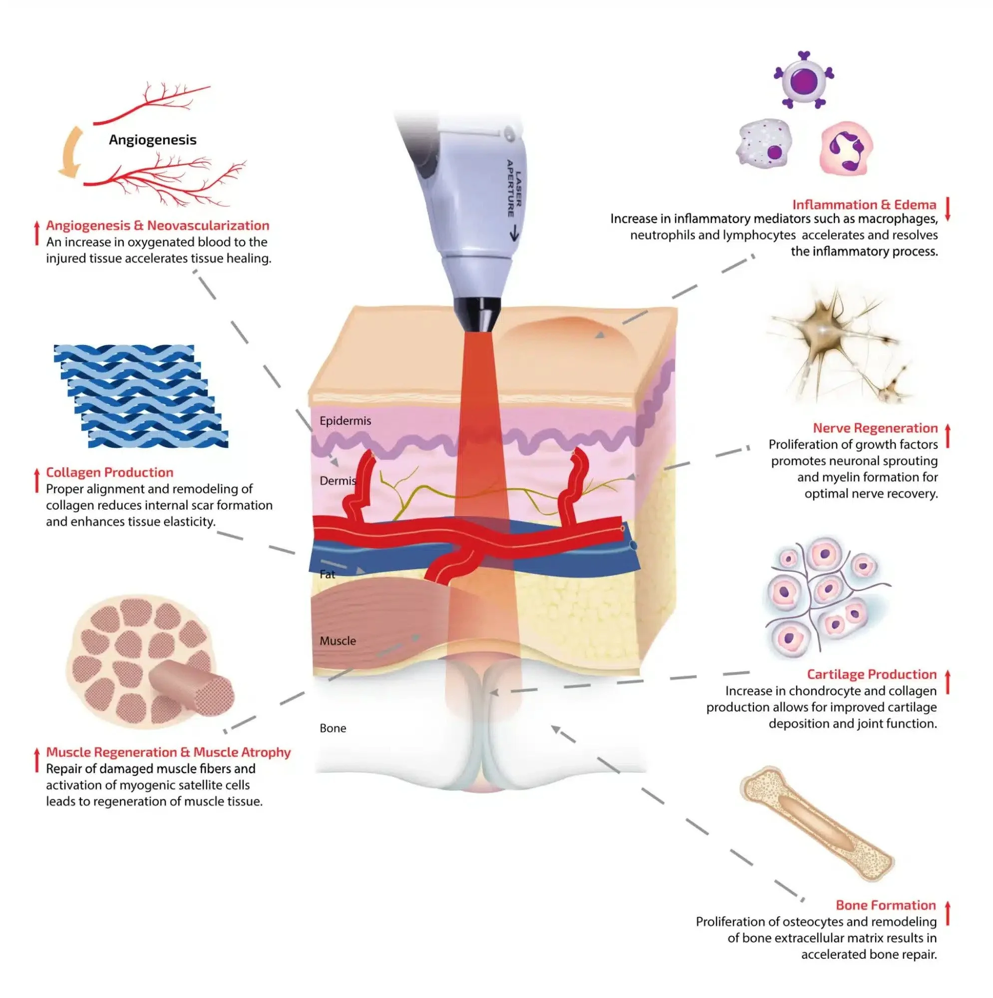Diagram showing laser treatment on skin, illustrating processes of angiogenesis, collagen production, muscle regeneration, inflammation reduction, nerve regeneration, cartilage production, and bone formation